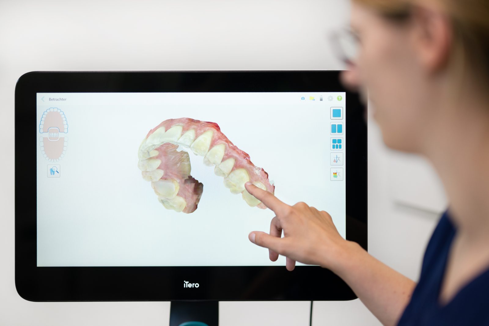 iTero Lumina Scan Aligner-Planung Digitaler 3D-Scan eines Zahnbogens am iTero Lumina – Planung der Invisalign-Behandlung in Lünen