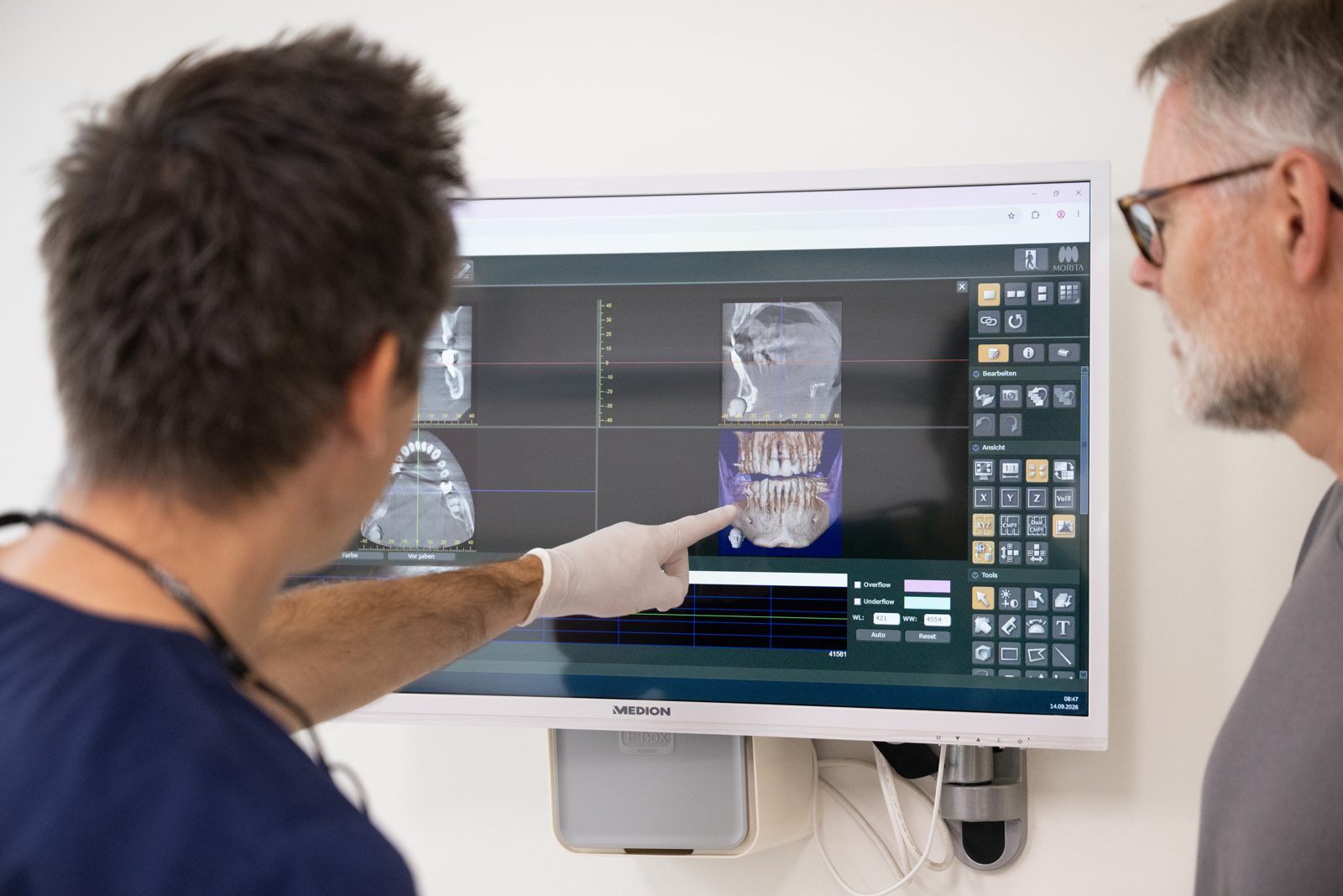 Implantologie Lünen – 3D-Diagnostik (DVT) mit dem Patienten besprechen Zahnarzt erklärt einem Patienten die 3D-Röntgenaufnahme (DVT) am Monitor – Implantatplanung in Lünen